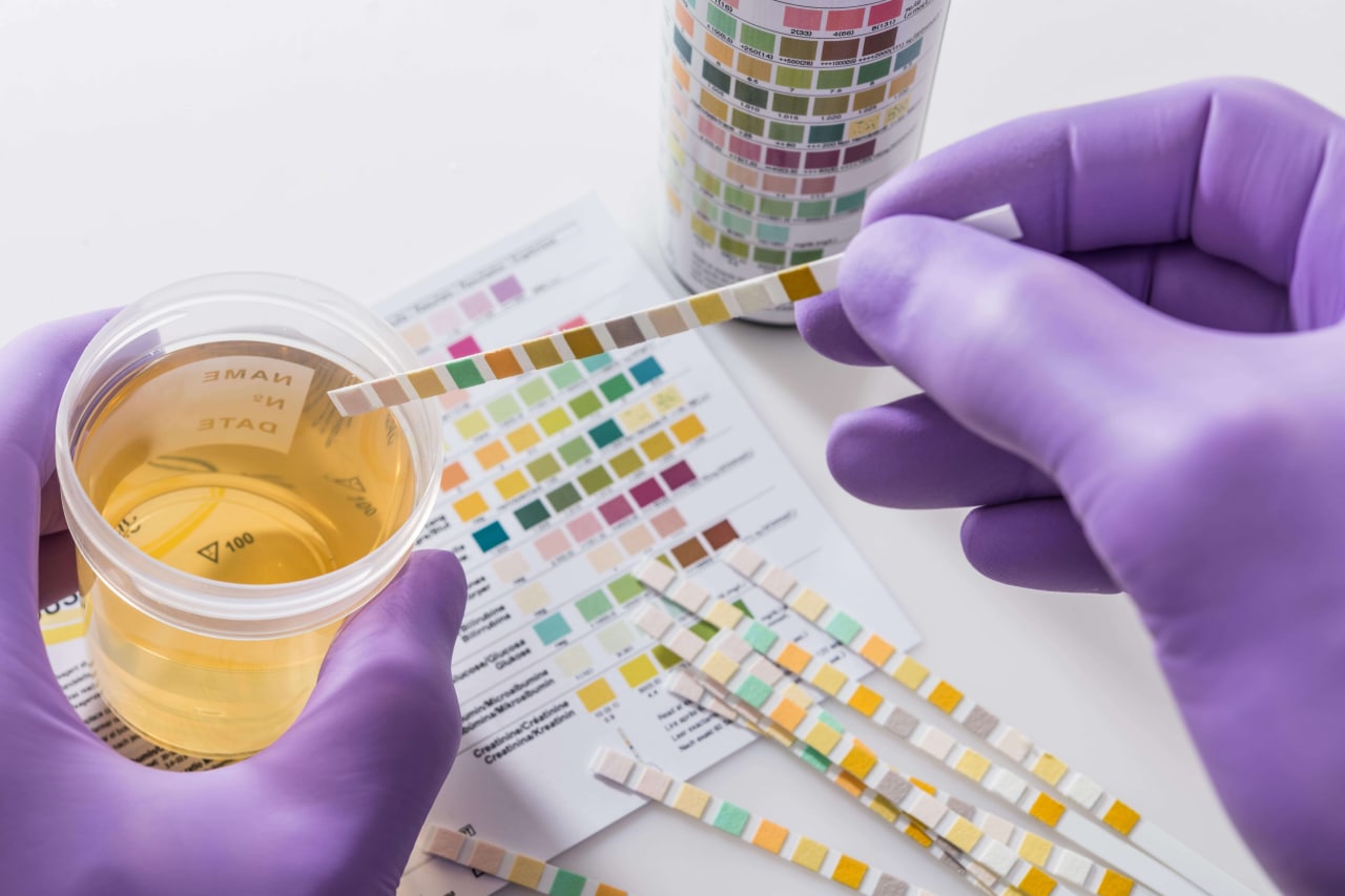 Toxicology: Drug Testing